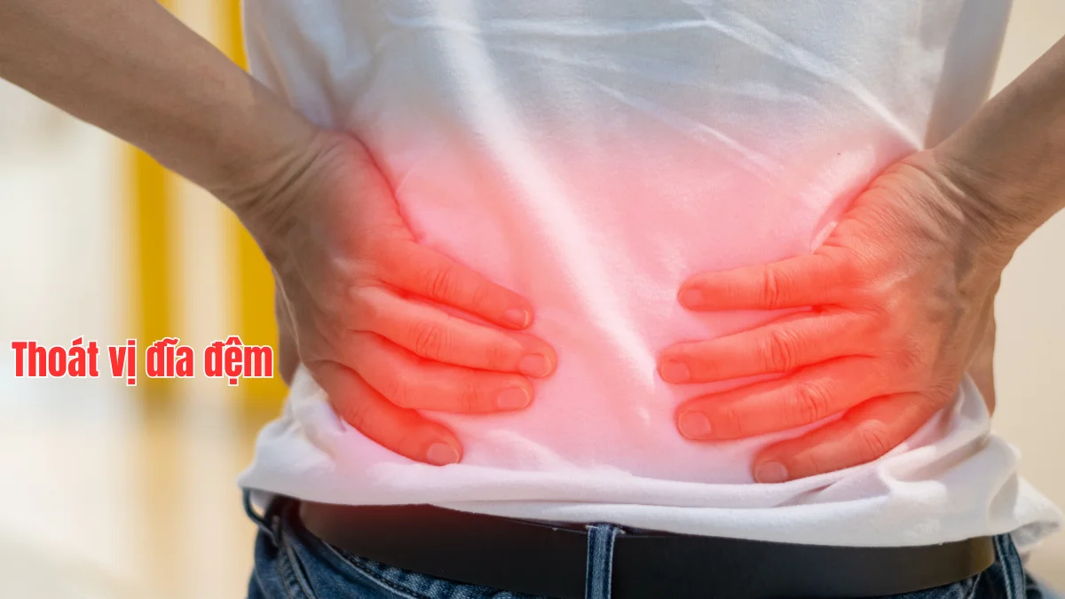 Thoát vị đĩa đệm